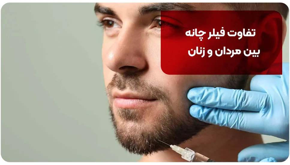 تفاوت فیلر چانه بین مردان و زنان