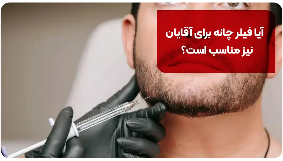 آیا فیلر چانه برای آقایان نیز مناسب است؟